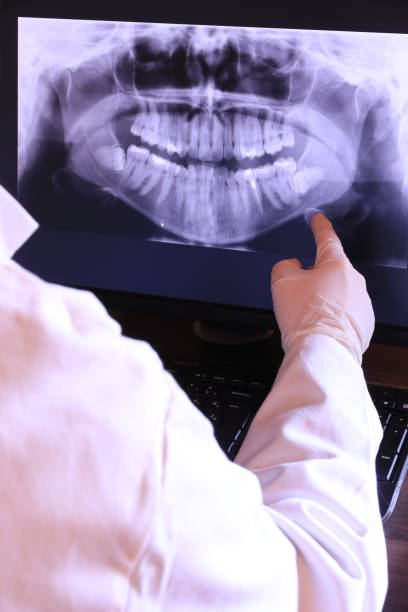 Best Emergency Root Canal Therapy in Baldwinville, MA